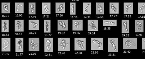 生物制藥研發-蛋白質聚集體.jpg